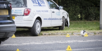 Resurfacing operative suffered serious head injuries when van ploughed into him