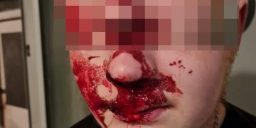Teenager assaulted by males armed with metal poles in village near Swindon
