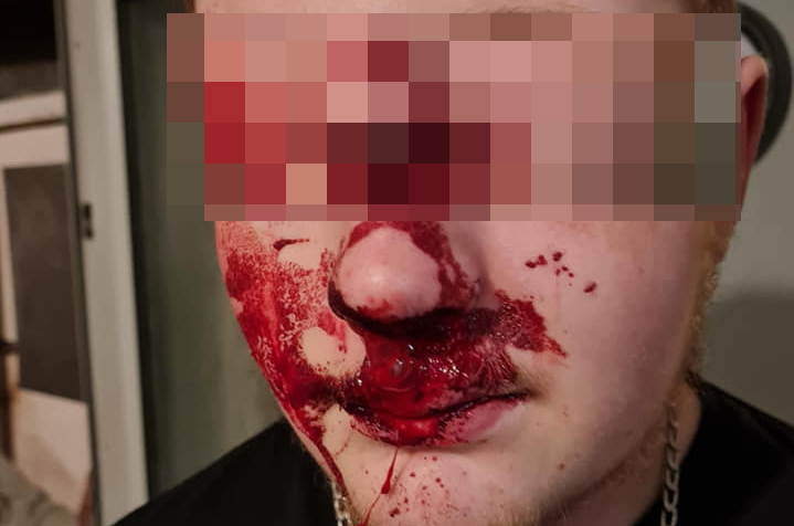 Teenager assaulted by males armed with metal poles in village near Swindon