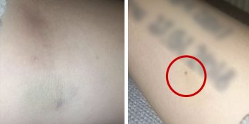 Woman, 24, ‘needed CPR after being spiked by injection’ out clubbing in Swindon