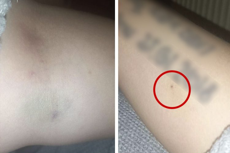 Woman, 24, ‘needed CPR after being spiked by injection’ out clubbing in Swindon