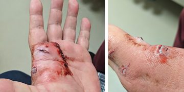 Elderly man attacked by German Shepard while saving cat from being savaged