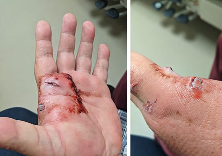 Elderly man attacked by German Shepard while saving cat from being savaged