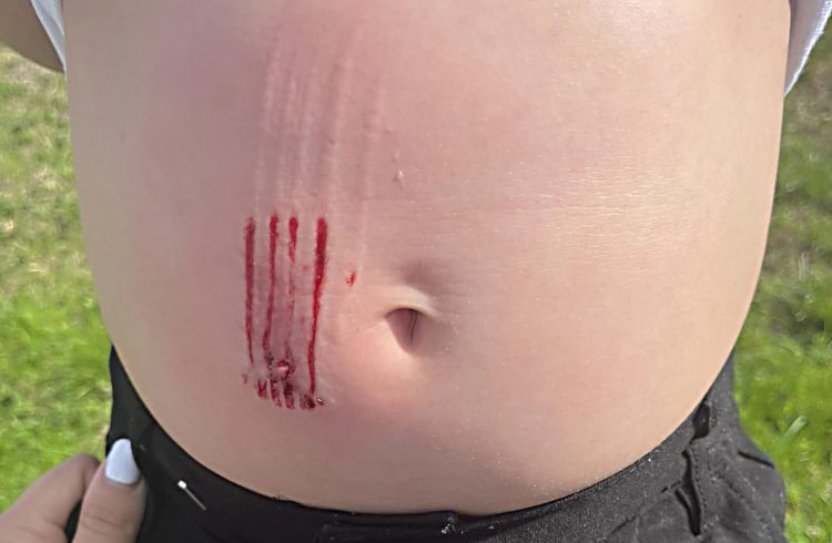 Police to investigate after young boy viciously attacked by dog in Swindon