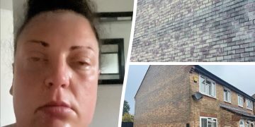 “My house is going to kill me” claims Calne mum with swollen face