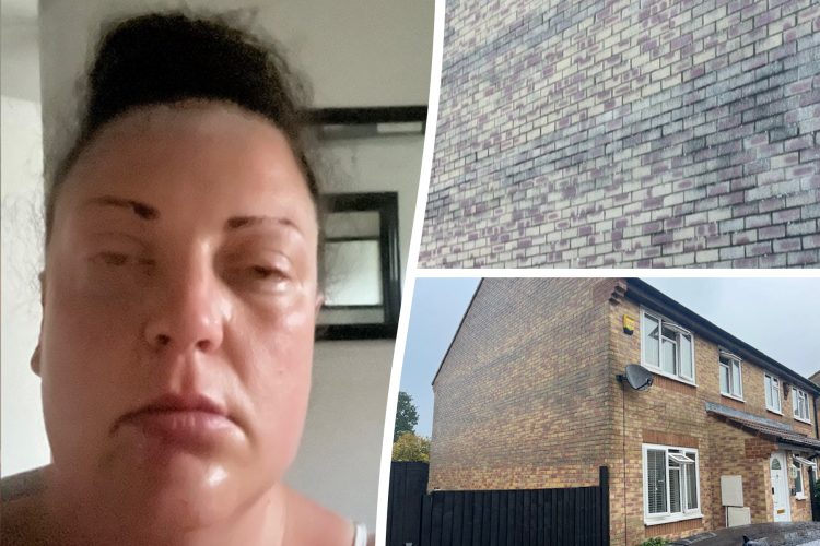 “My house is going to kill me” claims Calne mum with swollen face