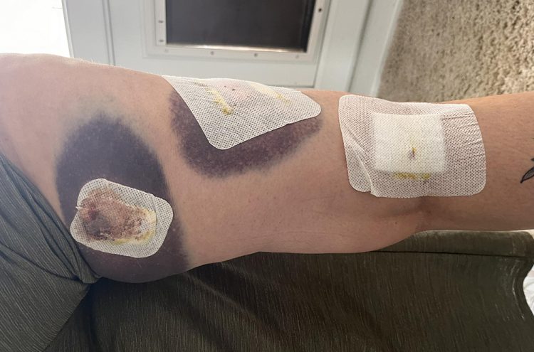 Woman attacked by dog in Swindon left needing hospital treatment