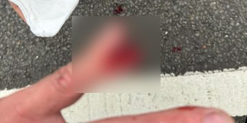 Cyclist’s finger severed in crash with car outside Swindon pub