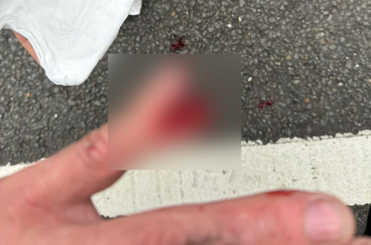 Cyclist’s finger severed in crash with car outside Swindon pub