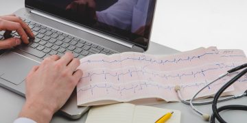 A projection of the ECG report