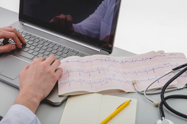 A projection of the ECG report