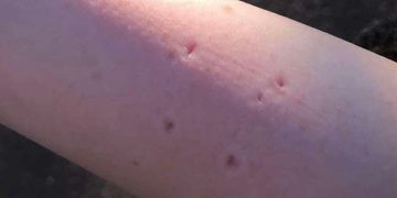 Owner speaks out after child bitten by cat in Trowbridge Town Park