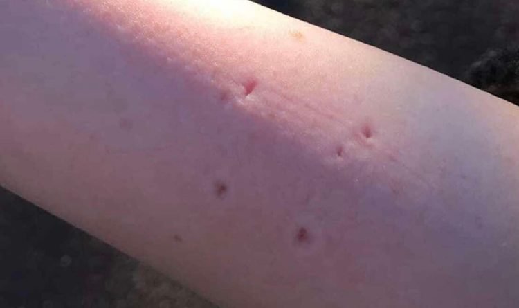 Owner speaks out after child bitten by cat in Trowbridge Town Park