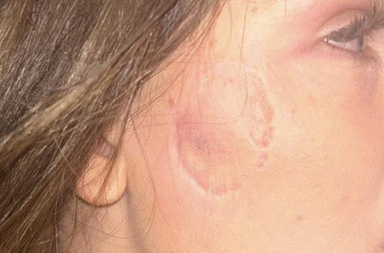 Attacker sinks teeth into woman’s cheek during Swindon incident