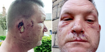 Swindon man’s ear ripped off by vicious XL Bully after falling asleep