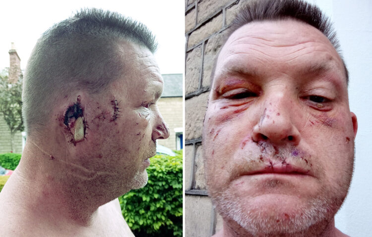 Swindon man’s ear ripped off by vicious XL Bully after falling asleep