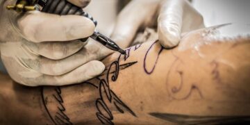 Moving On from Your Tattoo: The Options Compared