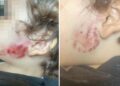 Roaming dog enters garden and bites toddler in Trowbridge attack