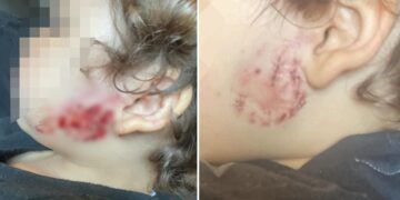 Roaming dog enters garden and bites toddler in Trowbridge attack