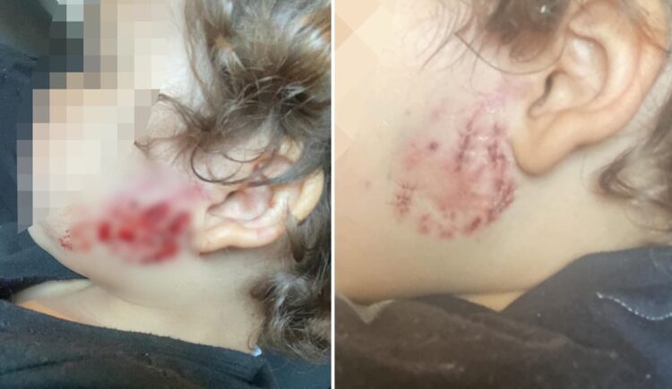 Roaming dog enters garden and bites toddler in Trowbridge attack