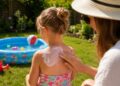 Child sunburn hospital cases soar as UK faces extreme heatwave