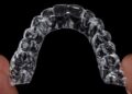 Oral Hygiene Tips During Clear Aligner Treatment